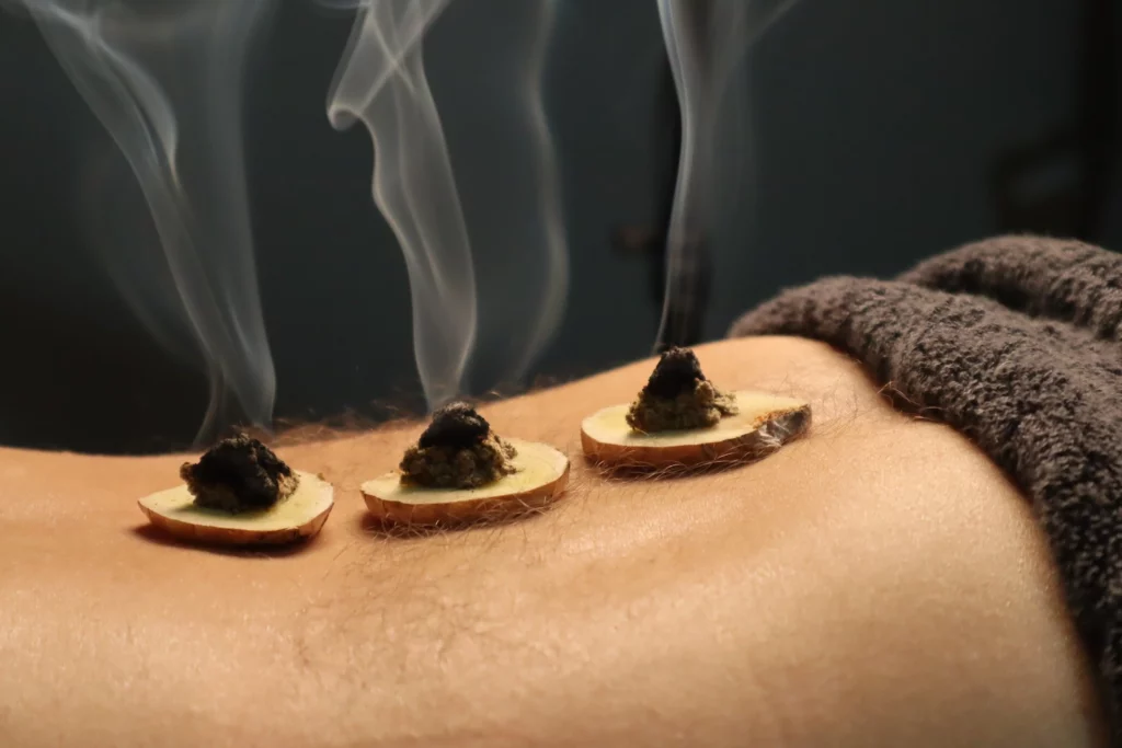 pratique de la moxibustion